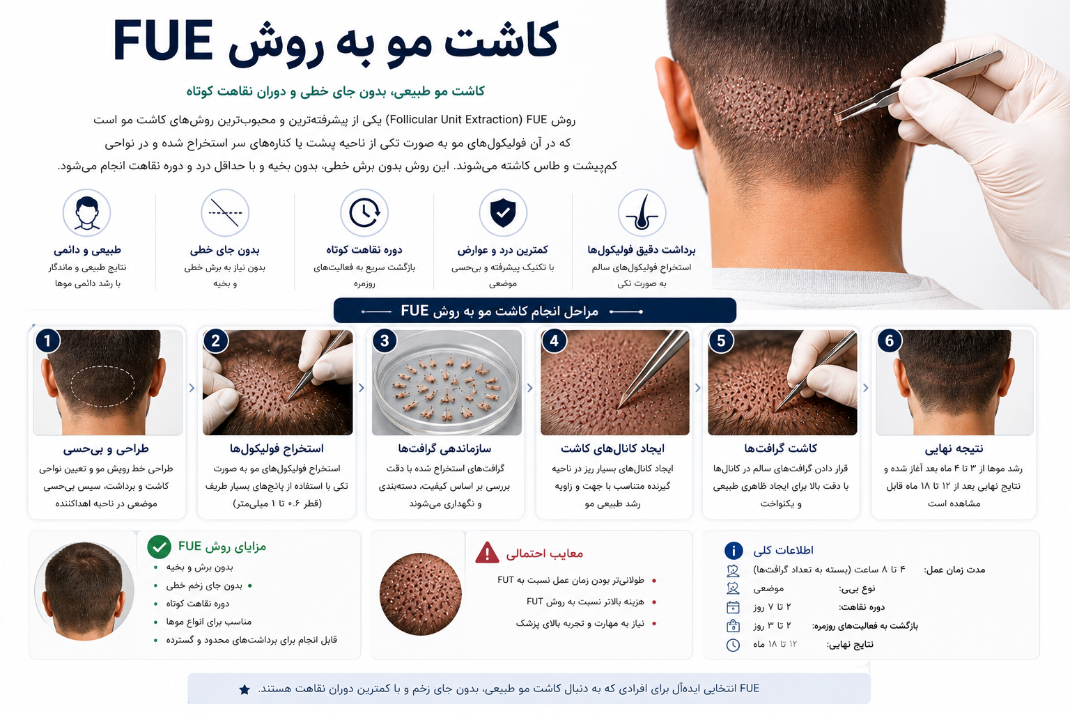 کاشت مو به روش FUE